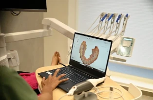 CBCT 3D dental scan in Bangalore